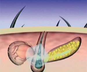 Hair Grow Max 2x1 a 49,99€